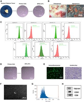 Exosomes Secreted by Nucleus Pulposus Stem Cells Derived From Degenerative Intervertebral Disc Exacerbate Annulus Fibrosus Cell Degradation via Let-7b-5p